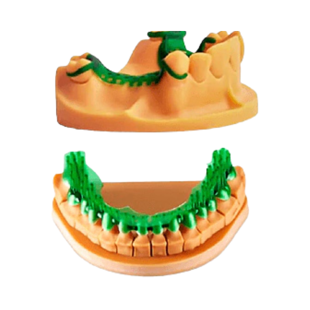 Estructura esquelética y puente impresos en ELEGOO Dental Castable verde ajustados sobre modelos dentales