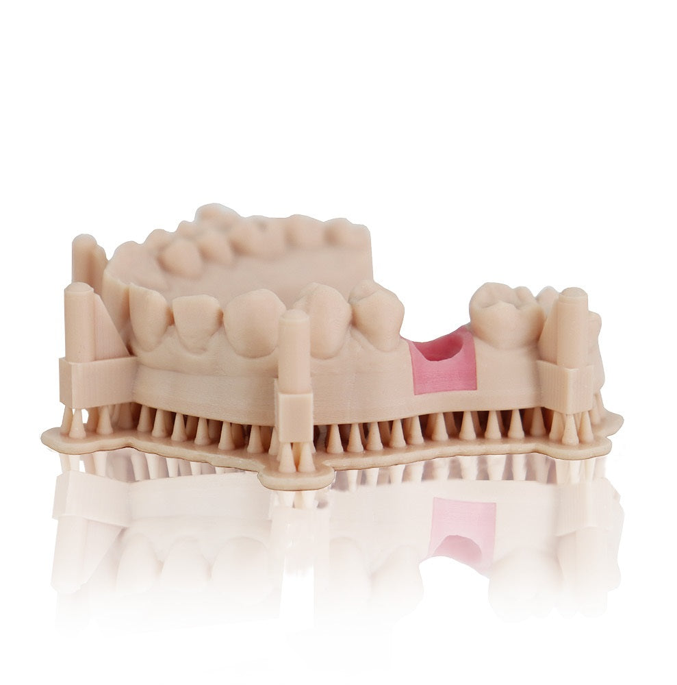 Modelo dental de implantes impreso en Liqcreate Dental Model Pro beige