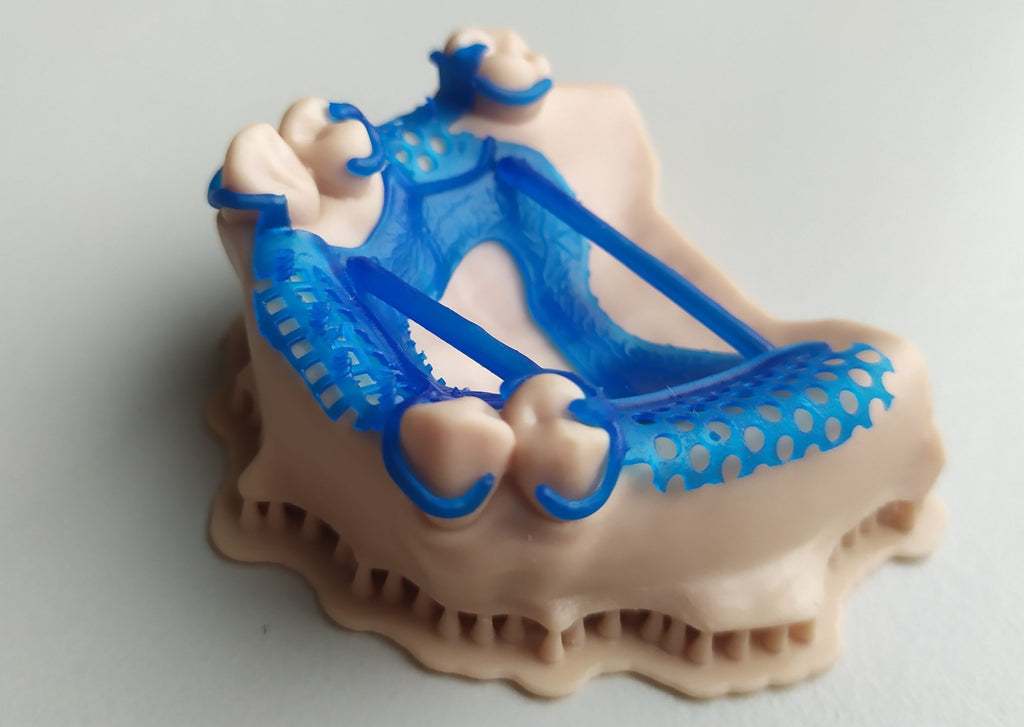 Estructura esquelética dental impresa en Liqcreate Wax Castable azul sobre modelo